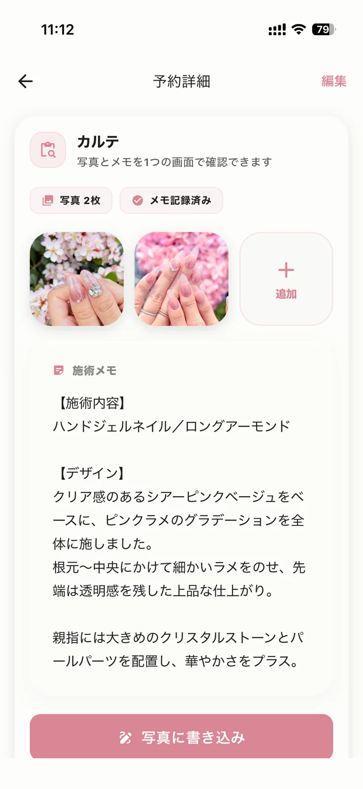 カルテ画面 — 写真と施術メモ